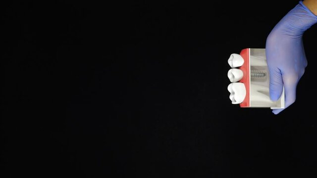 Dental concept on black background. Model of teeth and dental bridging crown being held by hands in blue gloves. Vertical footage. Removable partial denture, mandibular prosthesis. Medically