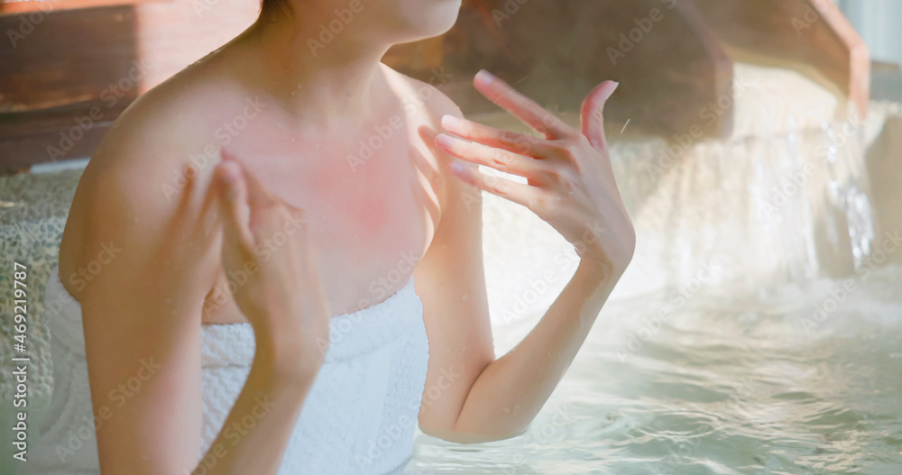 Poster woman feels hot in hot spring