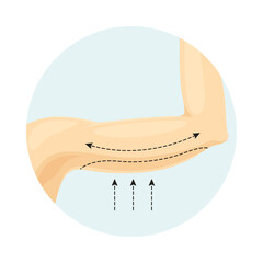Liposuction of arms. Plastic or cosmetic surgery vector illustration