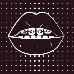 White line opened mouth with with braces on teeth