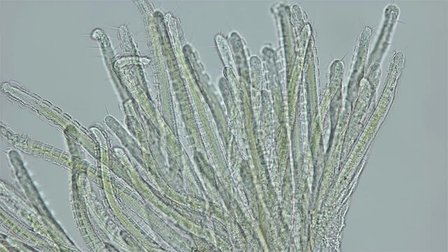 Polychaeta worm, order Sabellida under a microscope. Possibly family Fabriciidae. Video shows Radiole tentacles with many cilia that catch food, as well as gills. Indian Ocean