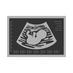 grey ultrasound picture of fetus