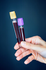 Pr&eacute;l&egrave;vement sanguin