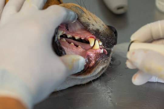 Ceaning tartar using ultrasonic scaler