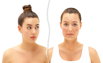 Effects of ageing,Frown/scowl lines ,Nasolabial folds,Neck ,Under eye circles,neck lines. Plastic...