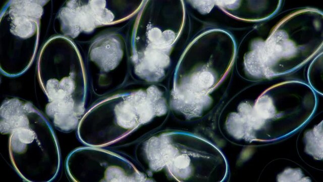 Eggs with Mollusca Nudibranchia embryos under a microscope, possibly Superfamily Fionoidea. They are attached to algae. Next stage, veliger, will float in water column. Barents Sea