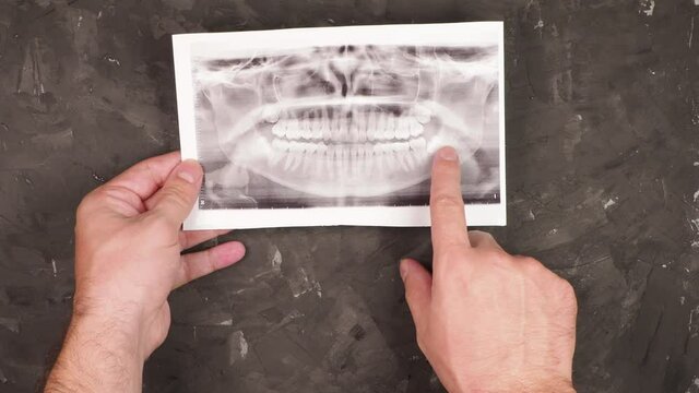 Hands of male orthodontist doctor holding a picture of teeth and examining it on black background