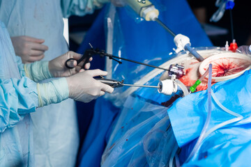 Selective focus on the hand of a surgeon with a laparoscopic manipulator. Minimally invasive...