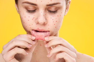 woman with red dots on her face skin problems dermatology dissatisfaction