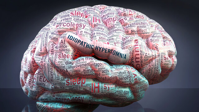 Idiopathic hypersomnia in human brain, hundreds of terms related to Idiopathic hypersomnia projected onto a cortex to show broad extent of this condition, 3d illustration