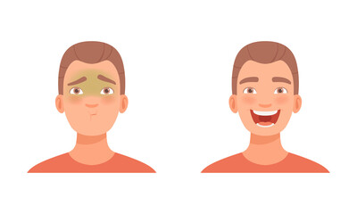 Man Head with Sickness and Laugh as Facial Expression Vector Set