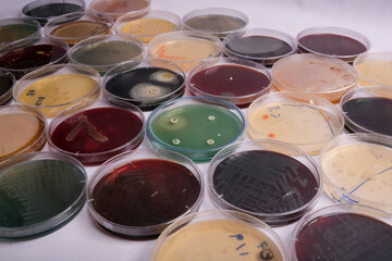 collection of culture plates contain growth of microorganisms on different agar media