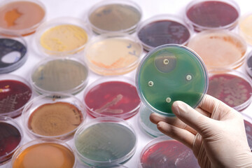 collection of culture plates contain growth of microorganisms on different agar media