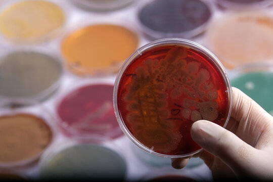 collection of culture plates contain growth of microorganisms on different agar media