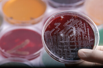 collection of culture plates contain growth of microorganisms on different agar media