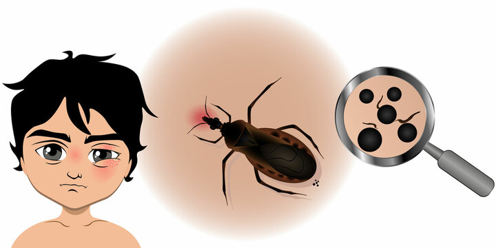Аmerican triatom bug on white background. Vector illustration