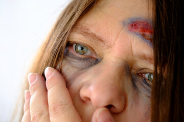 close-up of hand at female tear-stained face, beaten woman with bruises and abrasions, quiet cry...