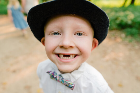 Closeup portrait of a young boy smiling with two missing front teeth