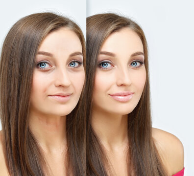 Aging. Mature woman-young woman.Face with skin problem.Showing photos before and after.