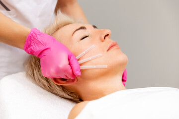 Thread lifting. Professional beautician in medical gloves holding needles. Close up face of adult...