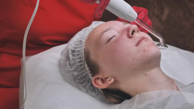 Darsonvalization of the face in a young girl with problem skin.