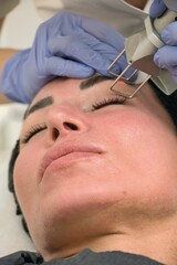 Obraz na płótnie Canvas Laser skin rejuvenation, eyelid correction, pigmentation removal, close-up