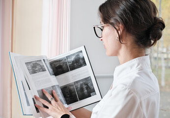 young woman radiologist referring to a book to find information on diagnostic issues. woman wearing medical uniform and glasses holding a book. side view.