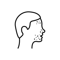 Boy with Pimples on Face Line Icon. Man with Blackhead, Acne, Rash Linear Pictogram. Dermatologic Problem, Allergy, Inflammation Skin Outline Icon. Editable Stroke. Isolated Vector Illustration