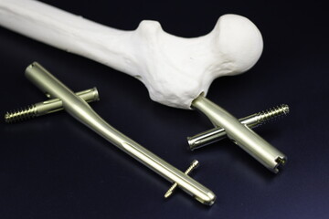 Surgical plates for osteosynthesis in case of operation  bone fractures