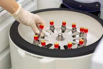 a doctor in a laboratory doing a blood test in a centrifuge. close up.  © Angelina Kosova