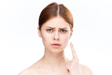 sad woman with bare shoulders red dots on her face