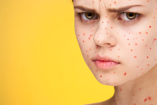 Woman With Red Dots On Her Face Skin Problems Dermatology Dissatisfaction