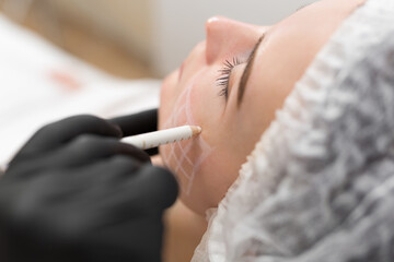 Obraz na płótnie Canvas Beautician draws the contours of a white pencil on the face of the patient. Schematic marking before contouring. Close-up preparation of the face for cosmetic plastic surgery
