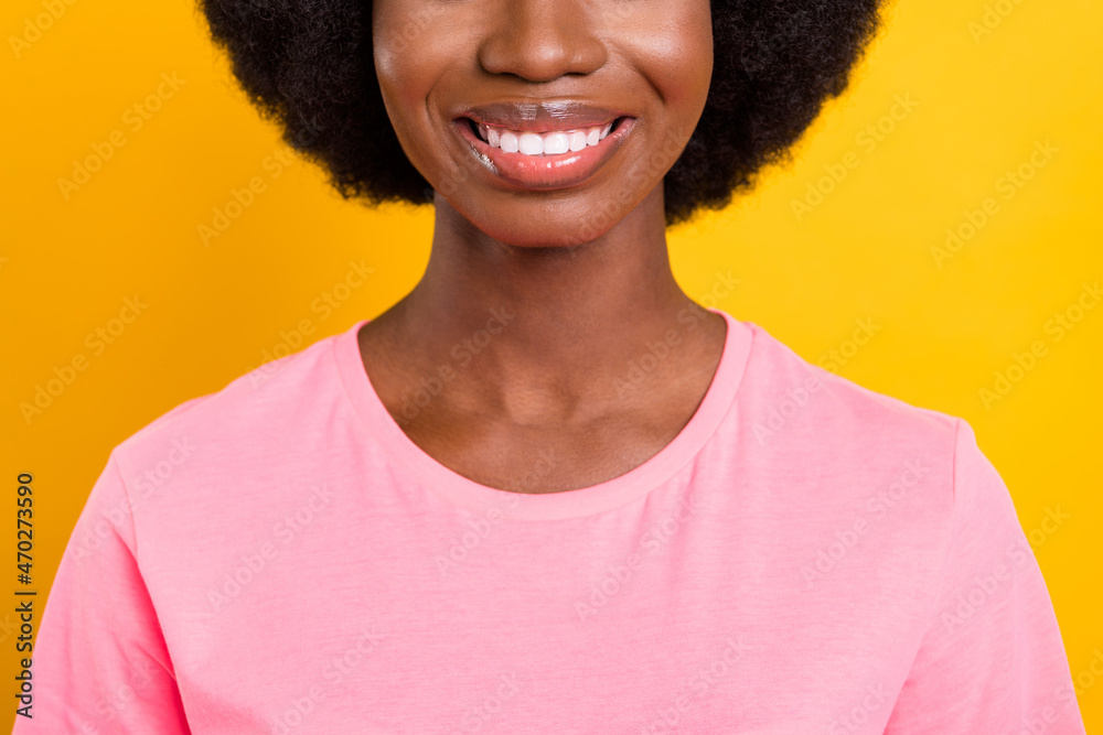 Wall mural Cropped photo of young black girl happy positive toothy smile ceramic veneers clinic isolated over yellow color background