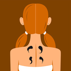 Vector graphics - the back of the head of a young woman with a hairstyle from the back with bare shoulders and four black leeches on the skin. Concept - hirudotherapy - alternative medicine