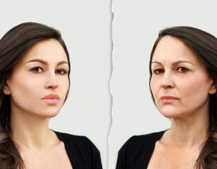 Aging. Mature woman-young woman.Face with skin problem.Showing photos before and after.