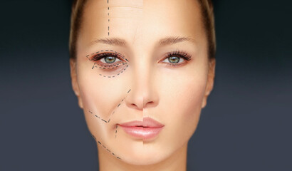 Aging. Mature woman-young woman.Face with skin problem.Showing photos before and after