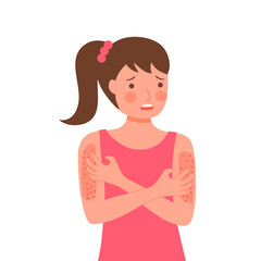 Girl scratching arms suffering strong allergy skin itchy symptom in flat design. Red rash skin irritation.