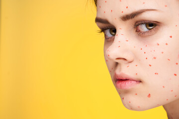 woman with red dots on her face skin problems dermatology dissatisfaction