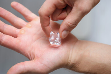 A piece of ice on the palm of a man, calluses on his hands