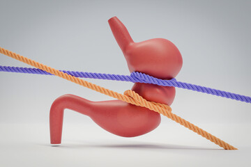 Anatomical model of human stomach, tied with rope.
concept for stomach cramps, feelings of hunger
 - obrazy, fototapety, plakaty