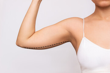 Cropped shot of a young woman with excess fat on her upper arm with marks for liposuction or plastic surgery isolated on a gray background. The loose and saggy muscles. Overweight. Beauty concept - obrazy, fototapety, plakaty