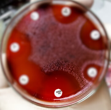 Antibiotic resistance test, selective focus show inhibition zone of Meropenem (mem) against microbial agent.