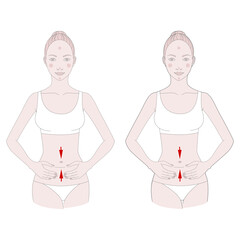 Half-figure of a girl. Self-massage of fatty deposits in the abdomen, illustration.