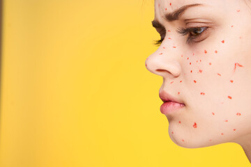woman with red dots on her face skin problems dermatology dissatisfaction