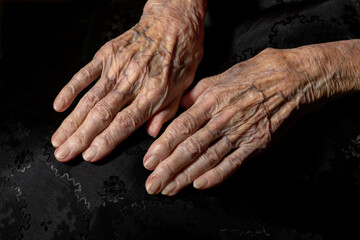 alte Hände , Haut und Falten, vom Leben gezeichnet, liegen auf dunklem Stoff.