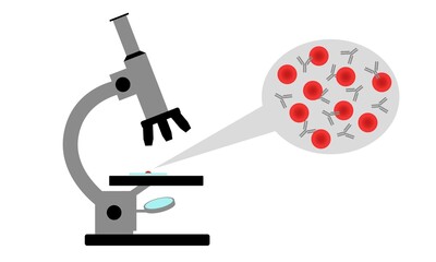 Examination of blood under a microscope for the presence of antibodies.