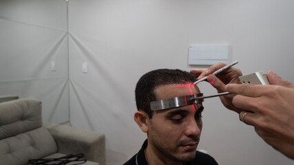 doctor scoring the points for hair transplant surgery