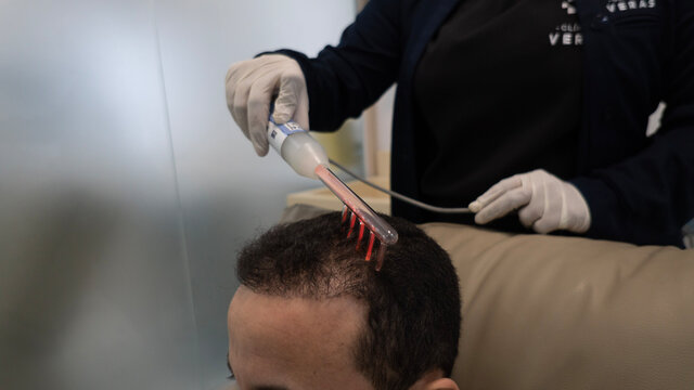 woman hand doing laser therapy on man's hair in medical clinic 