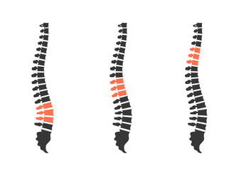 Back pain zones. Human spine silhouettes. Back ache. 